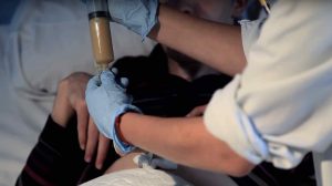 Cuidados de la alimentación enteral (PEG)