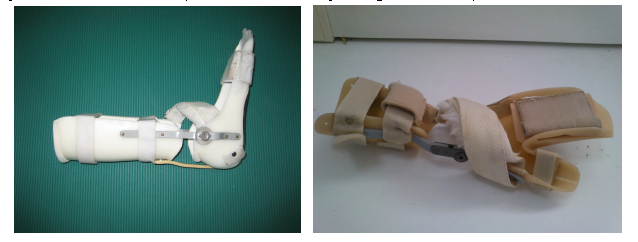 ortesis de flexo para mano y pie para pacientes de daño cerebral