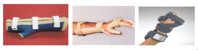 ortesis de mano para pacientes de daño cerebral