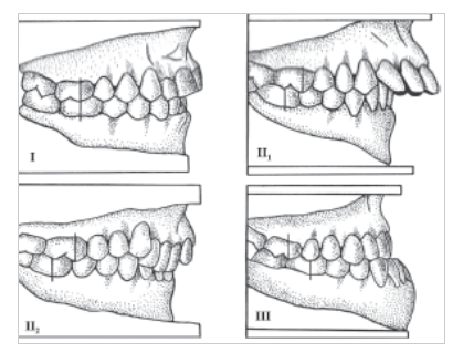 Imagen de la anatomía dental de la oclusión
