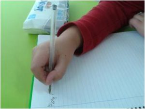 Cambio de dominancia en pacientes con daño cerebral