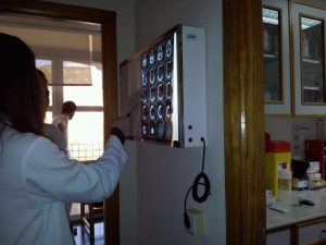 Imagn de dos profesionales sanitarios valorando una resonancia craneal