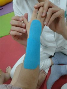 Vendaje neuromuscular en pacientes con daño cerebral