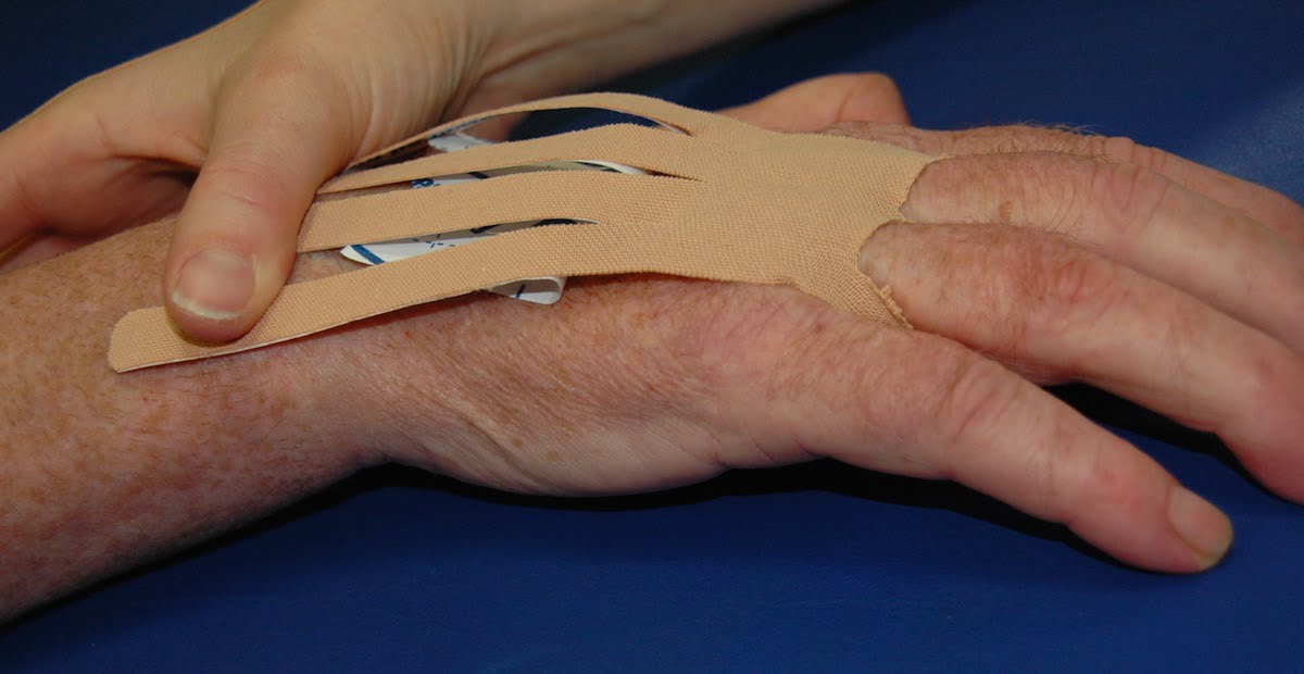 Aplicación del vendaje neuromuscular en manos paréticas