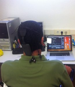 estimulación transcraneal de corriente directa