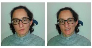 Paciente del servicio de daño cerebral de Hospitales vithas durante su rehabilitación