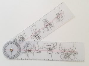 Valoración durante el proceso de rehabilitación fisioterapeútico en personas que sufren daño cerebral