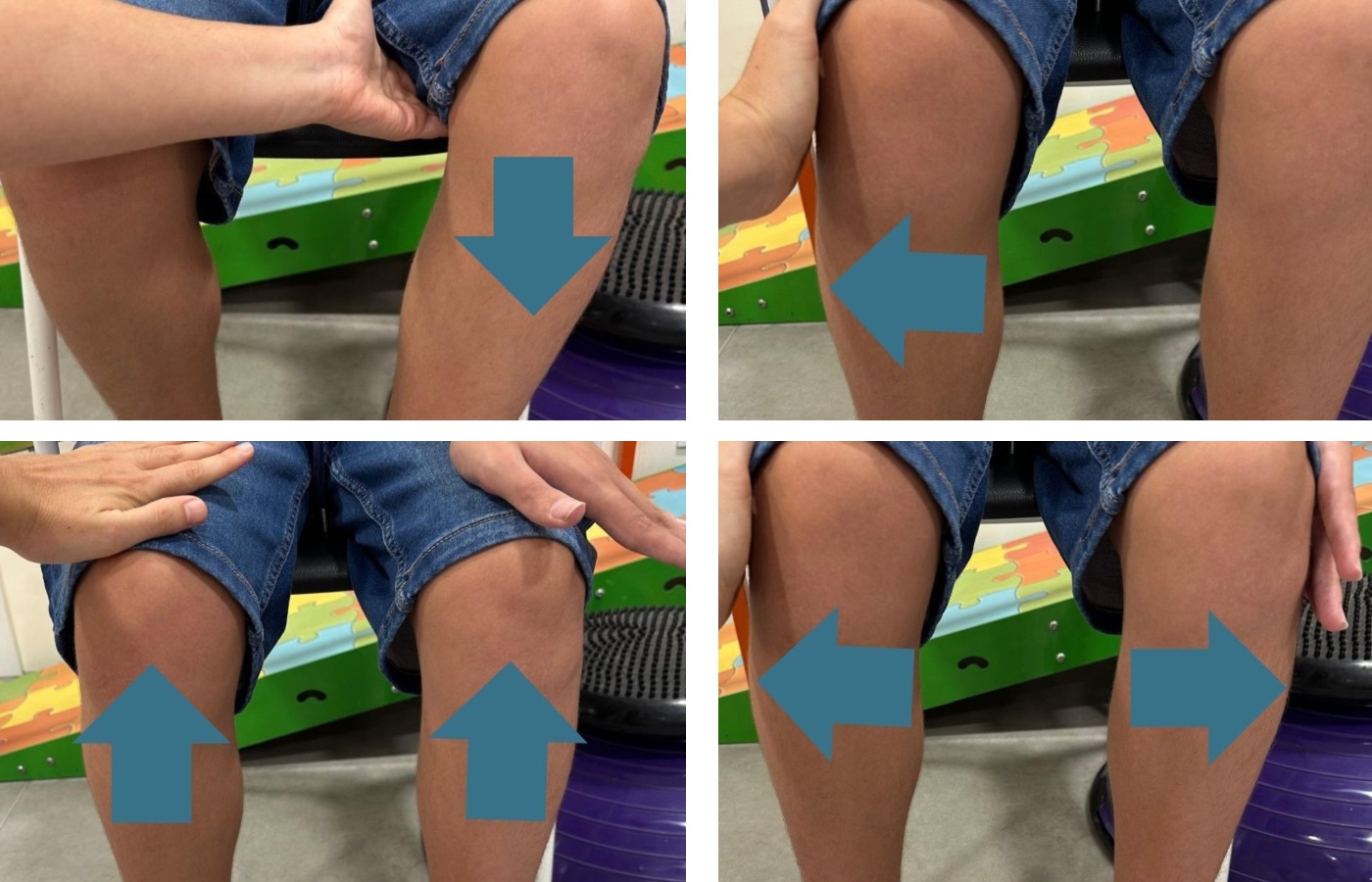 Evaluación de una niño con trastorno funcional neurológico durante una sesión de fisioterapia en Irenea